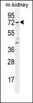 CYP5A1 antibody