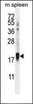 ZNF593 antibody