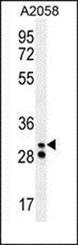 Neutrophil elastase antibody