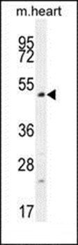 TSPYL4 antibody