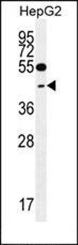 TXNL2 antibody