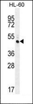 RINL antibody