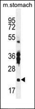 RBPMS2 antibody