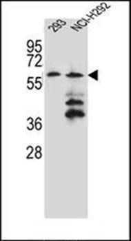PRAMEF12 antibody