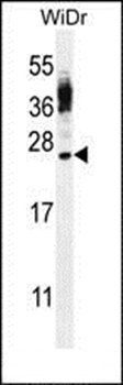 CT45A4 antibody