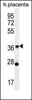 OR4L1 antibody