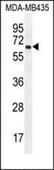 PRAMEF20 antibody