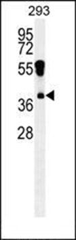 RHOXF2 antibody