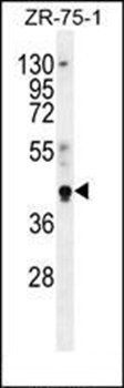 PYGO1 antibody