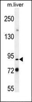 Mouse Parp9 antibody