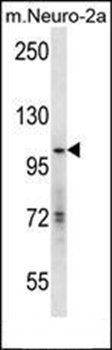 hGCN5 antibody