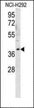 OR2AK2 antibody