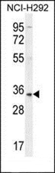 SFTPA2B antibody