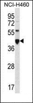 CEACAM18 antibody