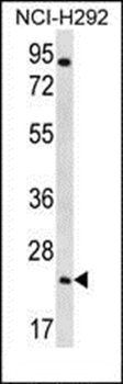 Aquaporin 5 antibody