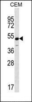 KCNJ8 antibody