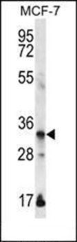 EVPLL antibody