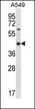 OR51S1 antibody