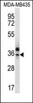 OR51Q1 antibody