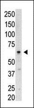 SENP3 antibody