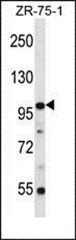 ZNF845 antibody