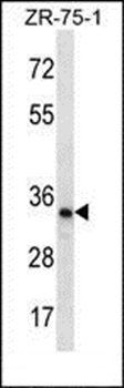 TLCD2 antibody