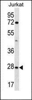 OR6T1 antibody