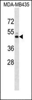 KCNJ13 antibody