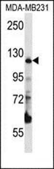 PITRM1 antibody