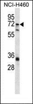 ST6GALNAC1 antibody