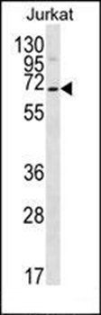 PSAPL1 antibody