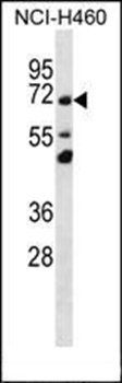 TM181 antibody