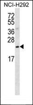 SLMO2 antibody