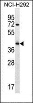 ARRDC5 antibody