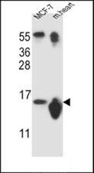 SNRPD3 antibody