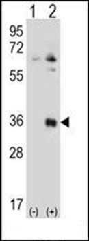 TSSK6 antibody