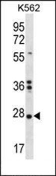 NKAIN1 antibody