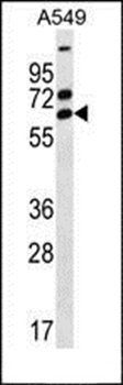 ZNF835 antibody