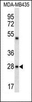 CDRT15L2 antibody