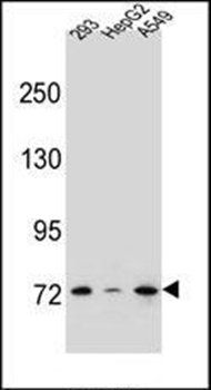 ZNF569 antibody