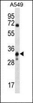 MCART6 antibody