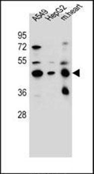 LRRC28 antibody