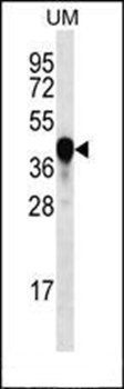 PROX2 antibody