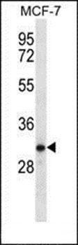 TESSP1 antibody