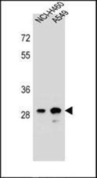 DHRS4L1 antibody