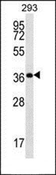 OR10H5 antibody