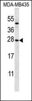 KLRC1 antibody