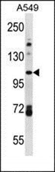 FA13B antibody