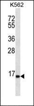 SPINK8 antibody