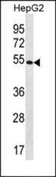 MGAT4C antibody